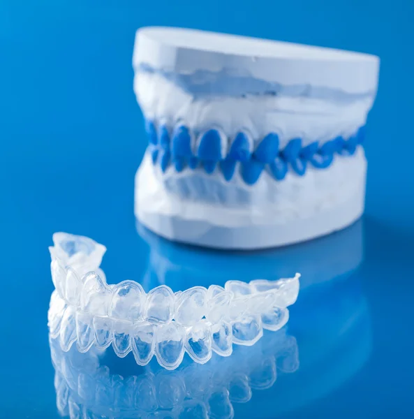 An Invisalign clear aligner at Wink Orthodontics, an orthodontist in Prosper, TX