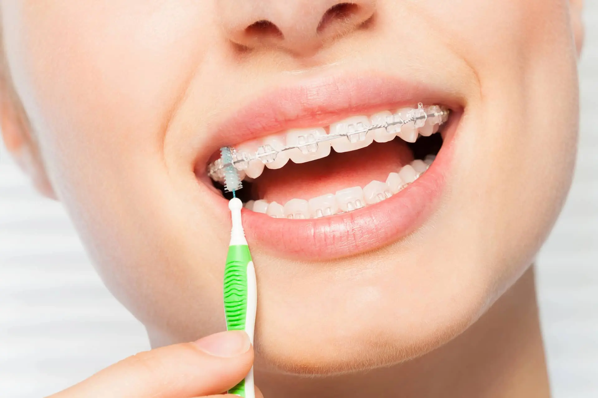 Person cleaning her clear braces with a green interdental brush, focusing on the teeth at Wink Orthodontics in Prosper and Colleyville, TX