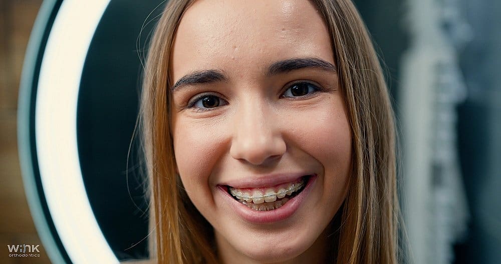 a woman smiling close to the camera showing her clear braces as one of the Alternatives to Braces in Prosper and Colleyville, TX.