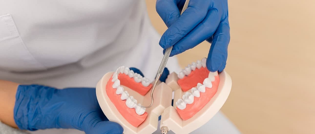 Demonstration of dental cleaning for overbites at Wink Orthodontics in Prosper or Colleyville, TX, using blue gloves and models.