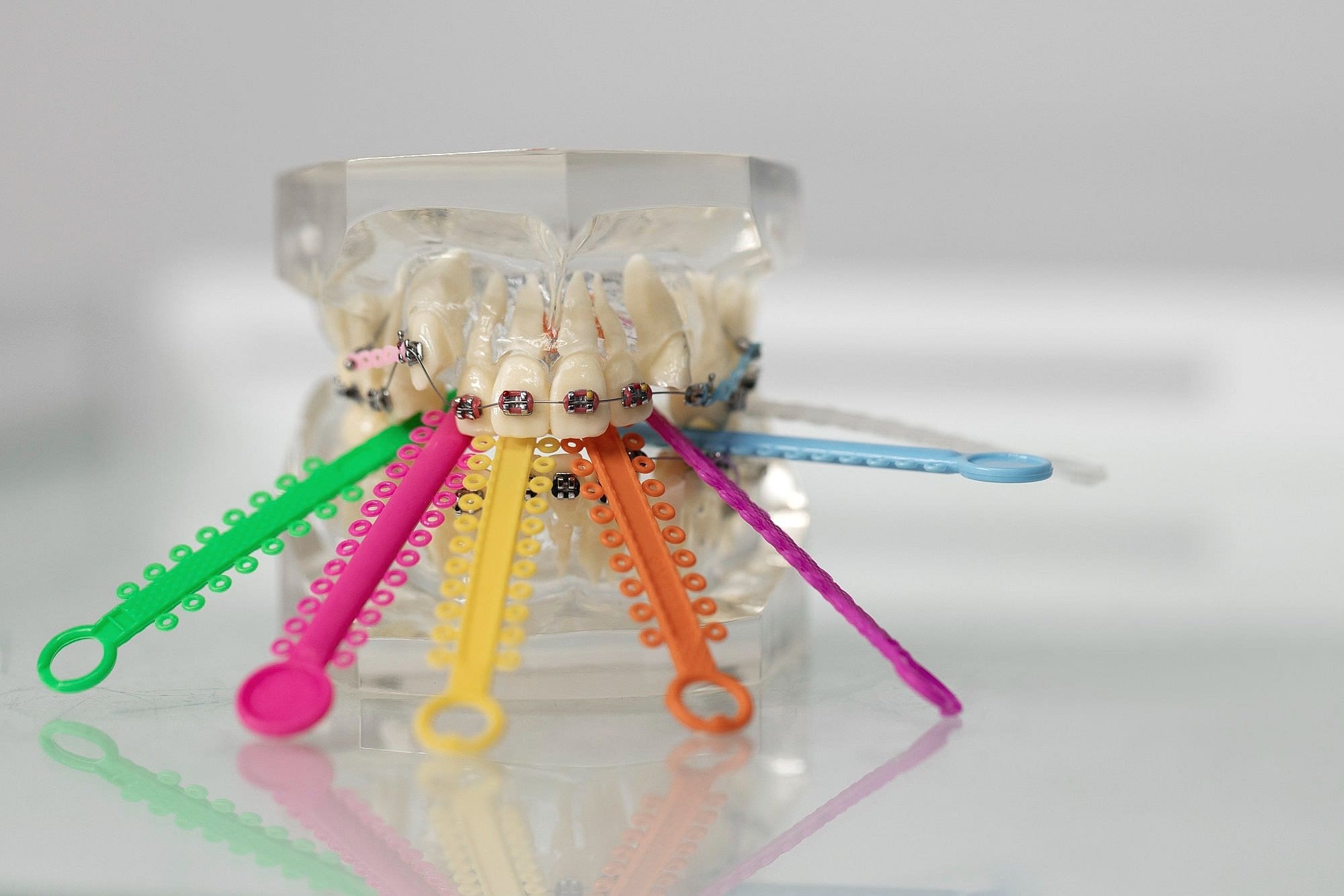 Close up on dentist instruments with metal braces in Prosper or Colleyville, TX