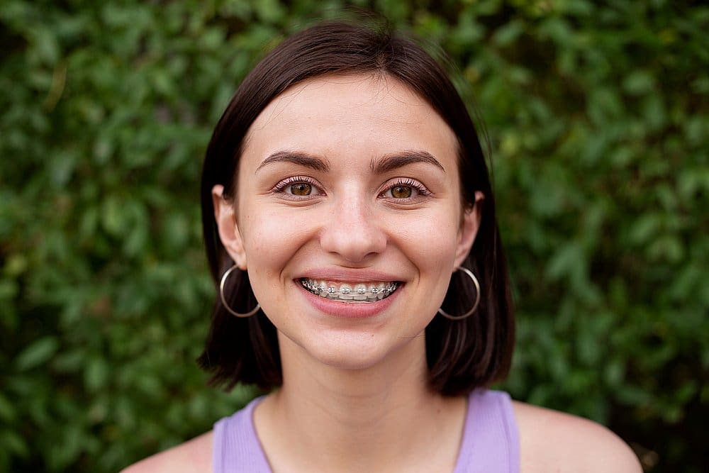 A young woman with straight brown hair, hoop earrings, and metal braces smiles at the camera against a leafy green backdrop, reflecting the cheerful atmosphere at Wink Orthodontics in Colleyville, TX.