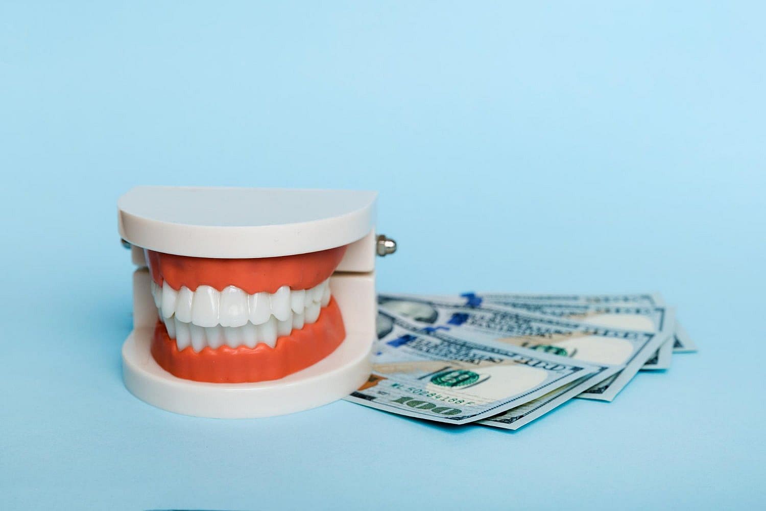 Fake teeth and hundred-dollar bills on blue highlight metal braces cost at Wink Orthodontics in Prosper or Colleyville, TX.